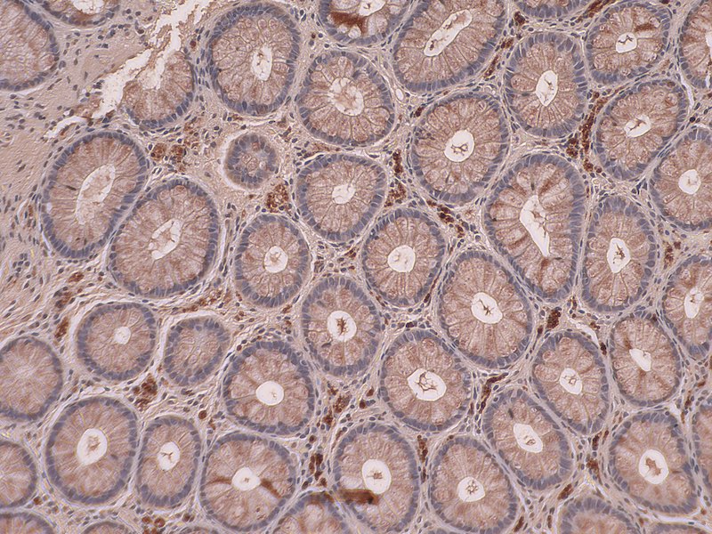 Gut Biopsy
